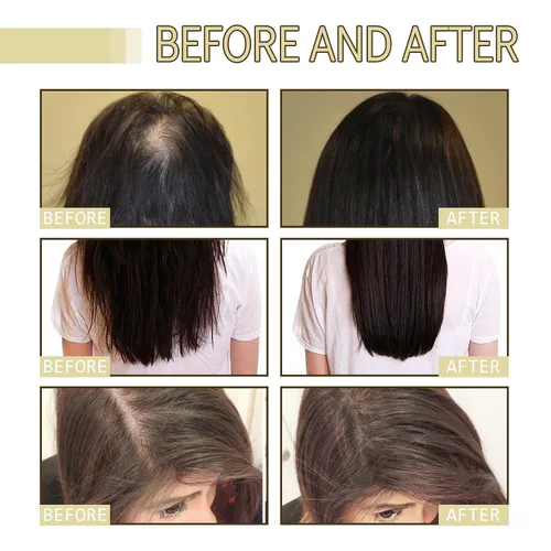 Vista 3 de Aceite natural para el crecimiento del cabello, aceite para cabello fino, seco y dañado (1 unidad)
