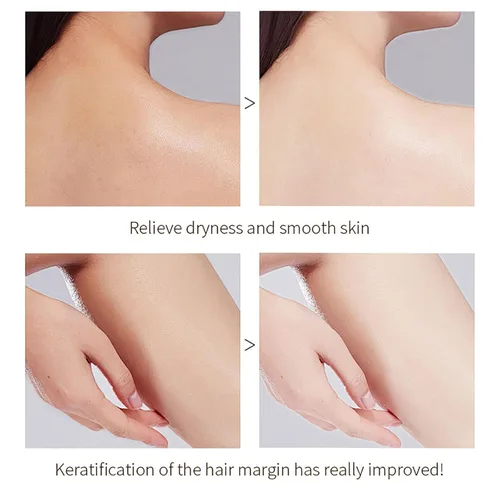 Vista 2 de Gel exfoliante naranja para cara y cuerpo, exfoliante profundo de poros, limpieza profunda de poros, geles exfoliantes de enzimas naranjas, gel