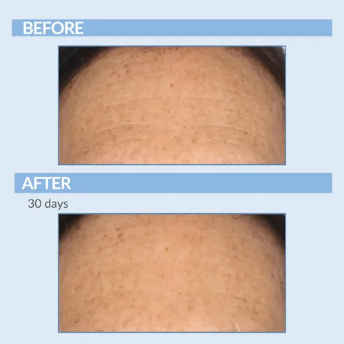 Vista 6 de Serious Skincare Vitamin A Force XR Retinol suero concentrado facial, micro exfoliante y rejuvenecimiento para piel radiante, para líneas, arrugas
