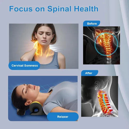 Vista 2 de Estirador de cuello con terapia magnética de acupresión para aliviar el dolor, relajante de cuello y hombros, almohada quiropráctica, restaurar