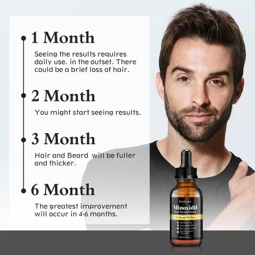 Vista 3 de Aceite de minoxidil para el crecimiento del cabello al 5% para hombres y mujeres, suero tópico extra fuerte para la pérdida del cabello, promueve
