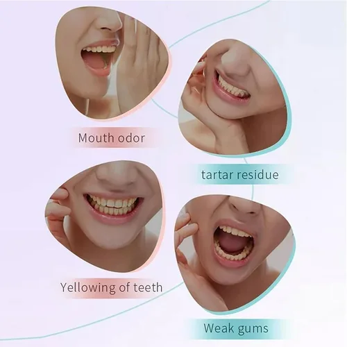 Vista 3 de Luvra - Pasta dental blanqueadora de niacinamida para adultos, blanqueamiento dental y eliminación profunda de manchas, combate el café, el té
