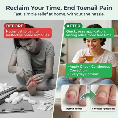 Vista 2 de Kit de tratamiento y corrector de uñas encarnadas de aleación de titanio de alta calidad, tiras correctoras hipoalergénicas para uñas de los pies