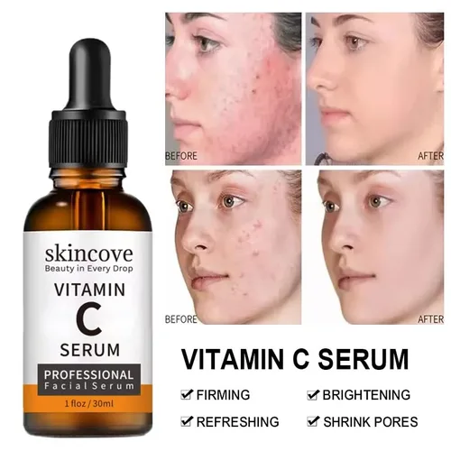 Vista 4 de Skincove - Suero facial antienvejecimiento con vitamina C, ácido hialurónico, suero iluminador de vitamina E, tono uniforme de la piel, mejora
