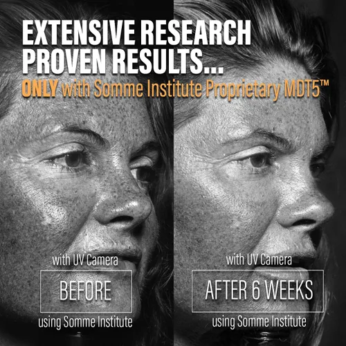Vista 7 de Hidratante diario con retinol Cara antienvejecimiento ultraligera sin aceite, para el cuello, el pecho hidratante A-Bomb hidrata, suaviza