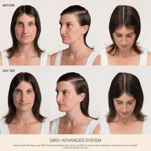 Vista 2 de VEGAMOUR GRO+ Suplementos avanzados para el crecimiento y la densidad del cabello