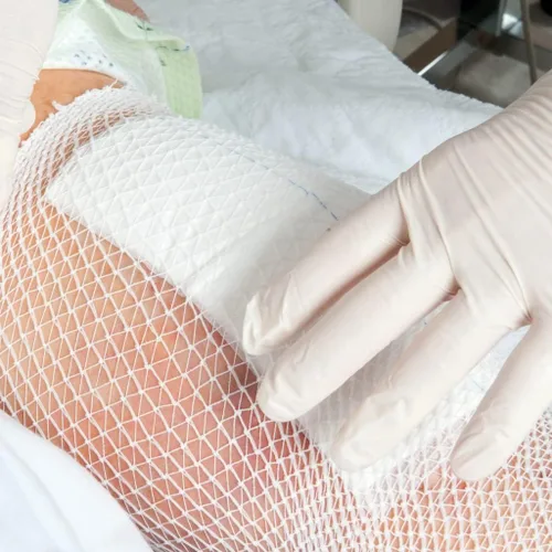 Vista 4 de Vakly ABD Pads 8" x 10" estériles (paquete de 20) – Almohadillas de gasa de combinación abdominal, apósitos no adherentes de alta absorción