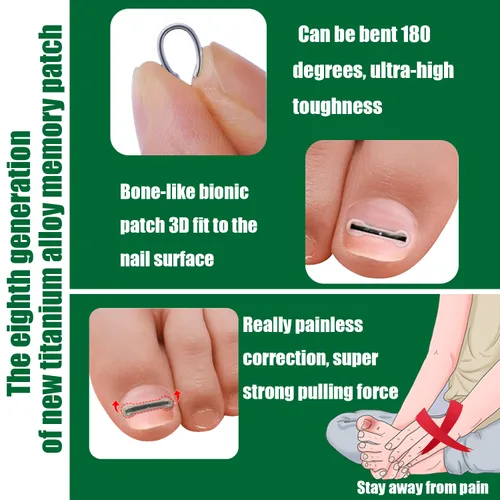Vista 4 de Corrector de uñas encarnadas de titanio, herramientas de reparación de uñas, tratamiento de uñas encarnadas, adecuado para la mayoría