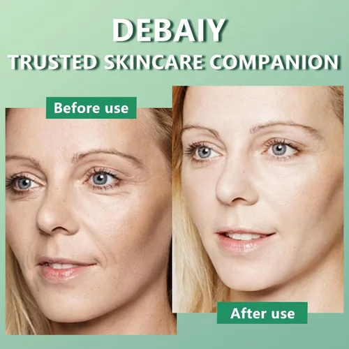 Vista 4 de Suero de niacinamida al 5% con 4% de extracto de árbol de té y centella asiática suero facial calmante