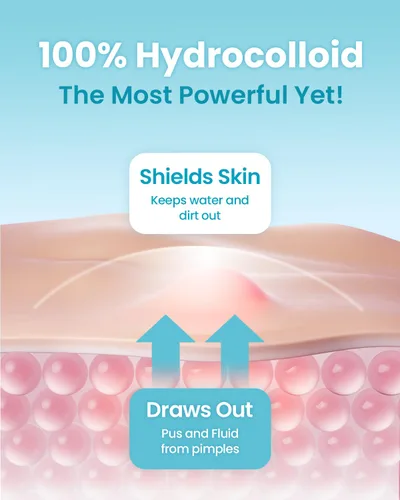 Vista 4 de GLAM UP Parches hidrocoloides para manchas de espinillas – Adhesivos invisibles ultrafinos para cara y piel, fuertes a prueba de agua y adhesivo