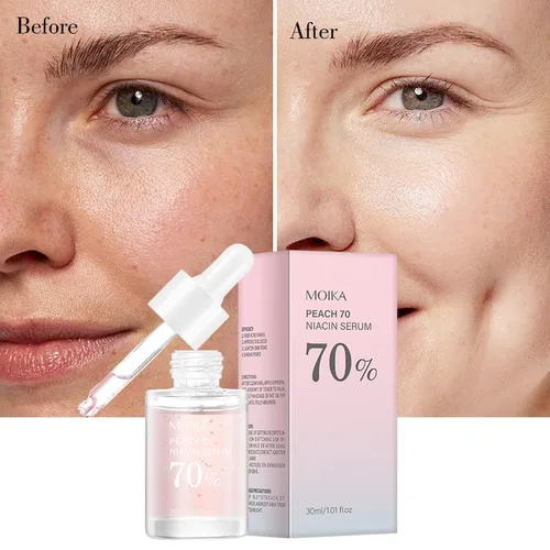 Vista 4 de Peach 70 - Suero de niacinamida, suero facial hidratante, suero facial para piel grasa, limpieza diaria para mujeres (1.0 fl oz)