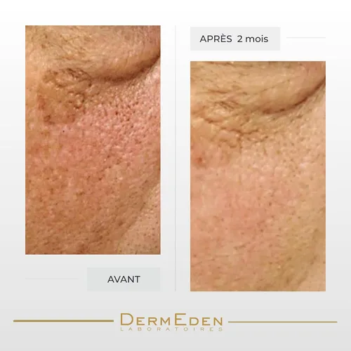 Vista 2 de DERMEDEN CREMA CONTORNO DE OJOS INTENSA NIGHT PROTOCOLE ANTI-AGE 15ML