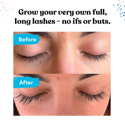Vista 2 de Silly George Suero de crecimiento de pestañas para cejas más gruesas, más llenas, más largas y atrevidas, suero premium, potenciador de pestañas