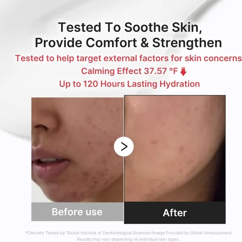 Vista 5 de medicube Almohadilla aclarante y crema calmante Duo: almohadilla de ácido succínico rojo y humectante diario 3H Exfoliación suave para una piel