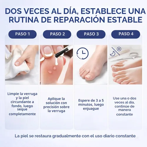 Vista 7 de Eliminador de verrugas de acción rápida con ácido salicílico al 40% para adultos, potente eliminación de verrugas plantares, verrugas comunes