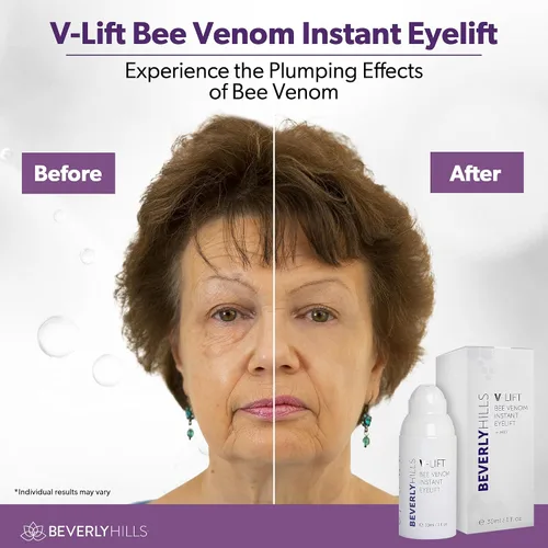 Vista 4 de Beverly Hills V-Lift - Suero de veneno de abeja para ojos hinchados, ojeras, arrugas y bolsas debajo de los ojos para mujeres y hombres, 1.0 fl oz