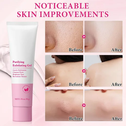 Vista 3 de Gel de pelado 1.76 oz de exfoliante facial y purificador de gel exfoliante facial, limpiador profundo de poros y exfoliante facial para control