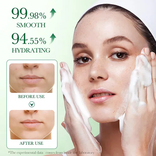Vista 2 de BIOAQUA Centella Asiatica Limpiador Facial Calmante Control de Aceite Anti-Acné Profundo Pore Limpio Facial Hidratante Hidratante 100g/3.5oz