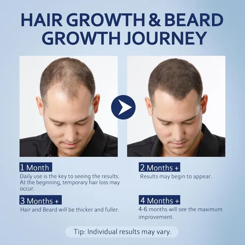 Vista 5 de Suero para el crecimiento del cabello de minoxidil al 5% para hombres y mujeres con biotina: minoxidil para hombres y mujeres, 5 por ciento