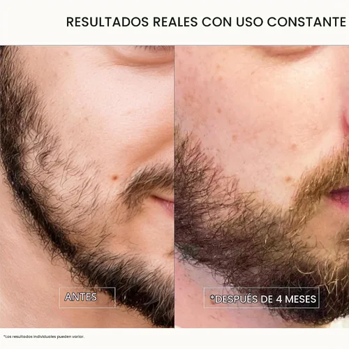 Vista 3 de Aceite para barba densificante, sin perfume, para barba más completa, 1 onza líquida