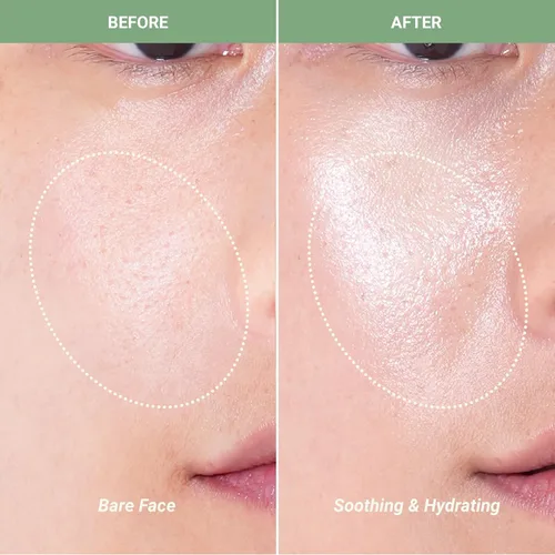 Vista 4 de Meebak CICA Toner Spray Spray facial coreano Spray facial con centella asiática y vitamina E Tónico facial calmante para pieles sensibles