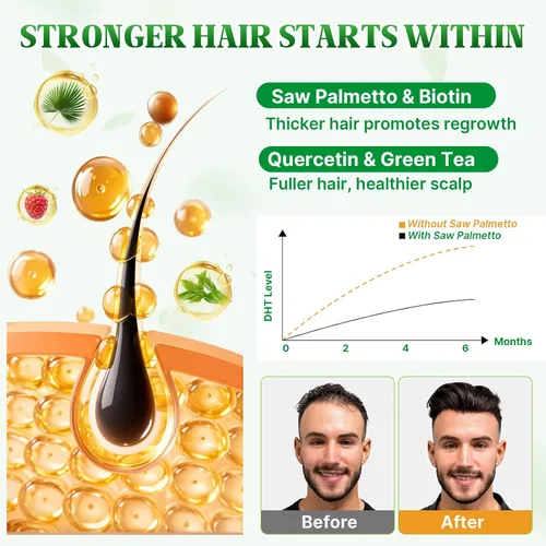 Vista 5 de Gomitas de palma enana americana Saw Palmetto Suplemento con aceite de semilla de calabaza, biotina, suplementos de salud para la próstata