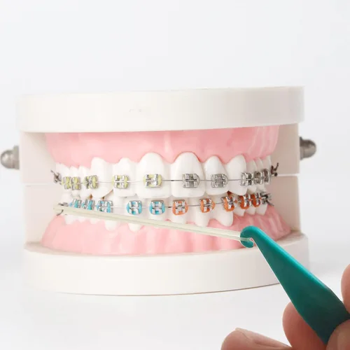 Vista 5 de Paquete de 20 bandas elásticas dentales para aparatos ortopédicos, multicolor, herramienta de banda de goma, desechables de plástico para ortodoncia