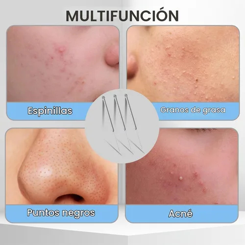 Vista 7 de Kit profesional para eliminar espinillas, 100 agujas desechables para el acné, herramientas para eliminar puntos negros, herramienta extractora