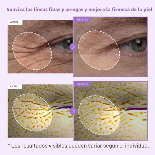 Vista 2 de TOSOWOONG Bakuchiol Cápsula Cream, Bakuchiol de alta pureza 5,000 ppm, cuidado alternativo de retinol antiarrugas, hidratante reafirmante