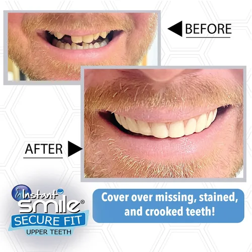 Vista 3 de Instant Smile Chapa de dientes superiores de ajuste seguro