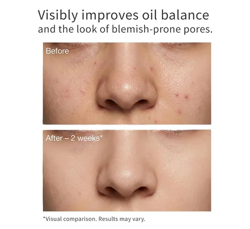 Vista 4 de Axwell Suero de niacinamida 10% + zinc 1% - Minimizador de poros y cuidado de manchas Suero facial - Control de aceite, se dirige a las manchas