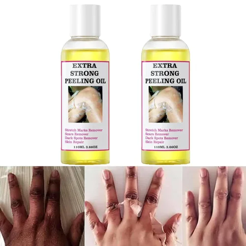 Vista 10 de Generic Aceite pelador amarillo extra fuerte para piel oscura, solución exfoliante para cuerpo, manos, pies y cara, todo