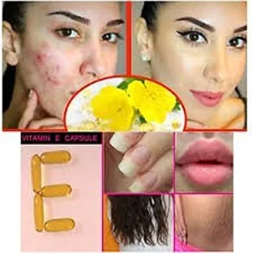 Vista 3 de Evion 400 mg vitamina E cápsula para cara, cabello, espinillas, piel brillante, ojeras, blanqueamiento de la piel y control de la pérdida de cabello