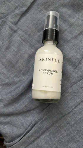 Vista 2 de Skinful Suero facial para piel propensa al acné - Suero anti acné para el acné facial y control de manchas, 2 onzas