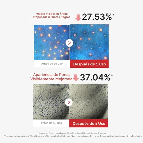 Vista 4 de medicube Mascarilla Exfoliante de Ácido Hipocloroso 3EA Mascarilla de Lámina Despegable para Exceso de Sebo, Poros y Puntos Negros Pantenol