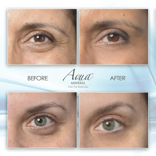 Vista 3 de Gel para ojos Puffy Eye Resultados instantáneos – Gel de ojos de reducción naturalmente rápida, elimina arrugas, hinchazón y bolsas – Gel hidratante