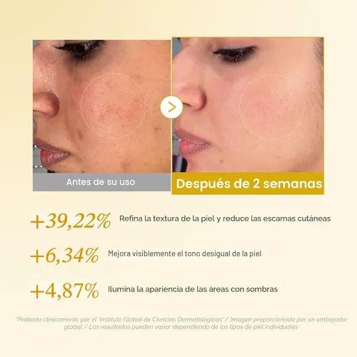 Vista 4 de medicube Tónico suavizante de cúrcuma de ácido kójico para rostro y cuerpo, tóner ligero para equilibrar el tono y la textura desiguales de la piel