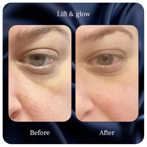 Vista 8 de Lift & Glow Crema de ojos orgánica para ojeras e hinchazón, crema de ojos antienvejecimiento para arrugas, reduce las ojeras y las bolsas debajo