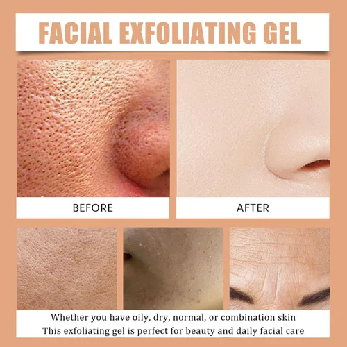 Vista 7 de Gel exfoliante facial, gel exfoliante naranja para cara, limpieza profunda, exfoliante, piel facial (1 unidad)