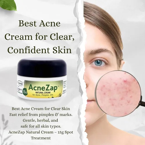 Vista 3 de Acne Zap Crema a base de azufre para cara, tratamiento eficaz del acné con azufre blanco, aceite de árbol de té y óxido de zinc para adultos