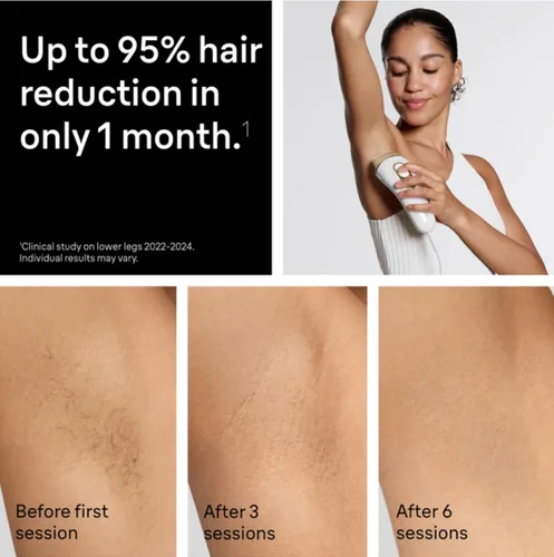 Vista 3 de Braun - Dispositivo de depilación láser de larga duración IPL para mujeres y hombres, Silk Expert Pro5 PL5157, cuerpo completo, con maquinilla