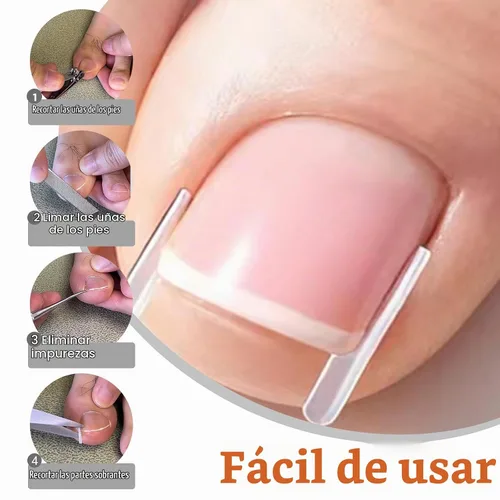 Vista 5 de Kit corrector de uñas encarnadas – tiras, parche, lima y levantador Breathable Ingrown Toenail Strips and curved toenail patch for home pedicure