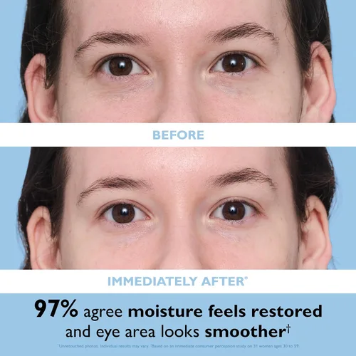 Vista 5 de Peter Thomas Roth – parches de ojo de gel hidratante hialurónico Water Drench