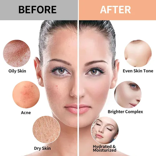 Vista 6 de Cherry & Pure Himala Yan Jelly Mask Máscara de gelatina para profesionales faciales, máscara facial de gelatina, máscara vajacial