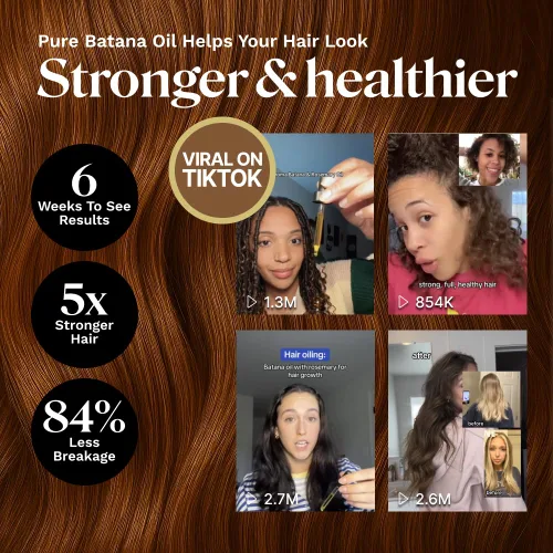Vista 4 de Keyoma Aceite de batana para el crecimiento del cabello con romero: nutre y desintoxica el cuero cabelludo para un cabello más grueso, más fuerte