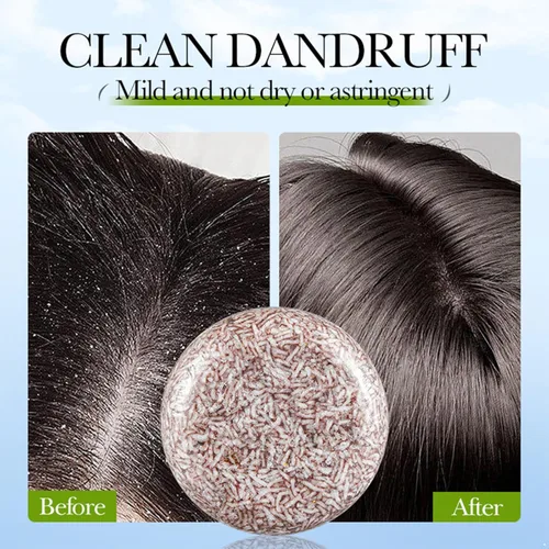 Vista 7 de Moily Barra de champú de oisturización, a base de plantas para hidratación y limpieza del cabello seco, carbón de bambú, talla única