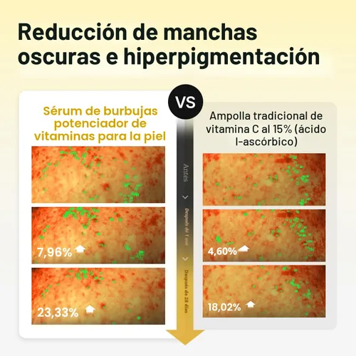 Vista 3 de MEDITHERAPY Suero de vitamina C para la cara, fórmula de microburbujas para absorción instantánea, brillo visiblemente radiante, vitamina C
