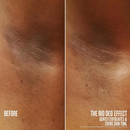 Vista 4 de Sol de Janeiro Rio Deo - Refillable Aluminum Free Deodorant Prevents Odor, Gently Exfoliates, Evens Skin Tone
