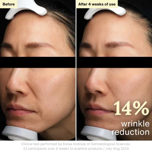Vista 8 de Rothea Crema de resiliencia, antienvejecimiento con Bakuchiol 10,000 ppm (alternativa natural al retinol), hidratante facial, crema para el cuello