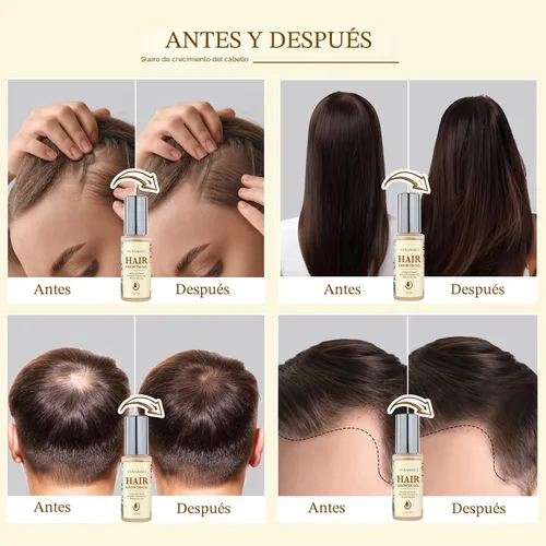 Vista 2 de Aceite para el crecimiento del cabello con romero y biotina: suero natural para el crecimiento del cabello para mujeres y hombres - Tratamiento anti
